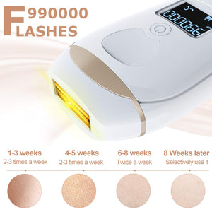 IPL Hair Removal, 990,000 Flashes